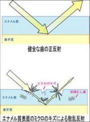 エナメル質の乱反射 ㈱サンギ提供